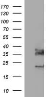 PathPlus™ SYP / Synaptophysin Antibody (clone 1C9)