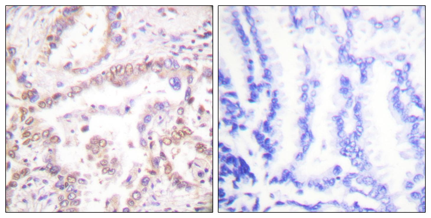 SKP2 Antibody