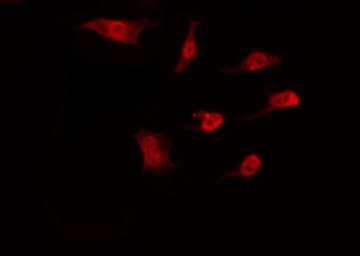 Polyclonal Rabbit anti-Human DNAJC17 Antibody (IF, WB)