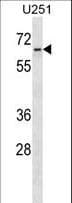 ZNF768 Antibody (aa3-29)