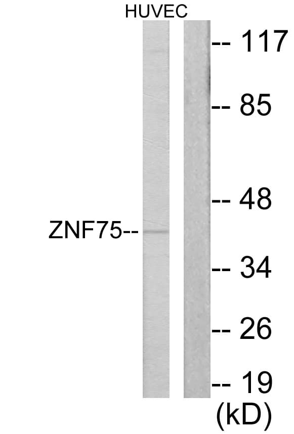 ZNF75 / ZNF75D Antibody (aa296-345)
