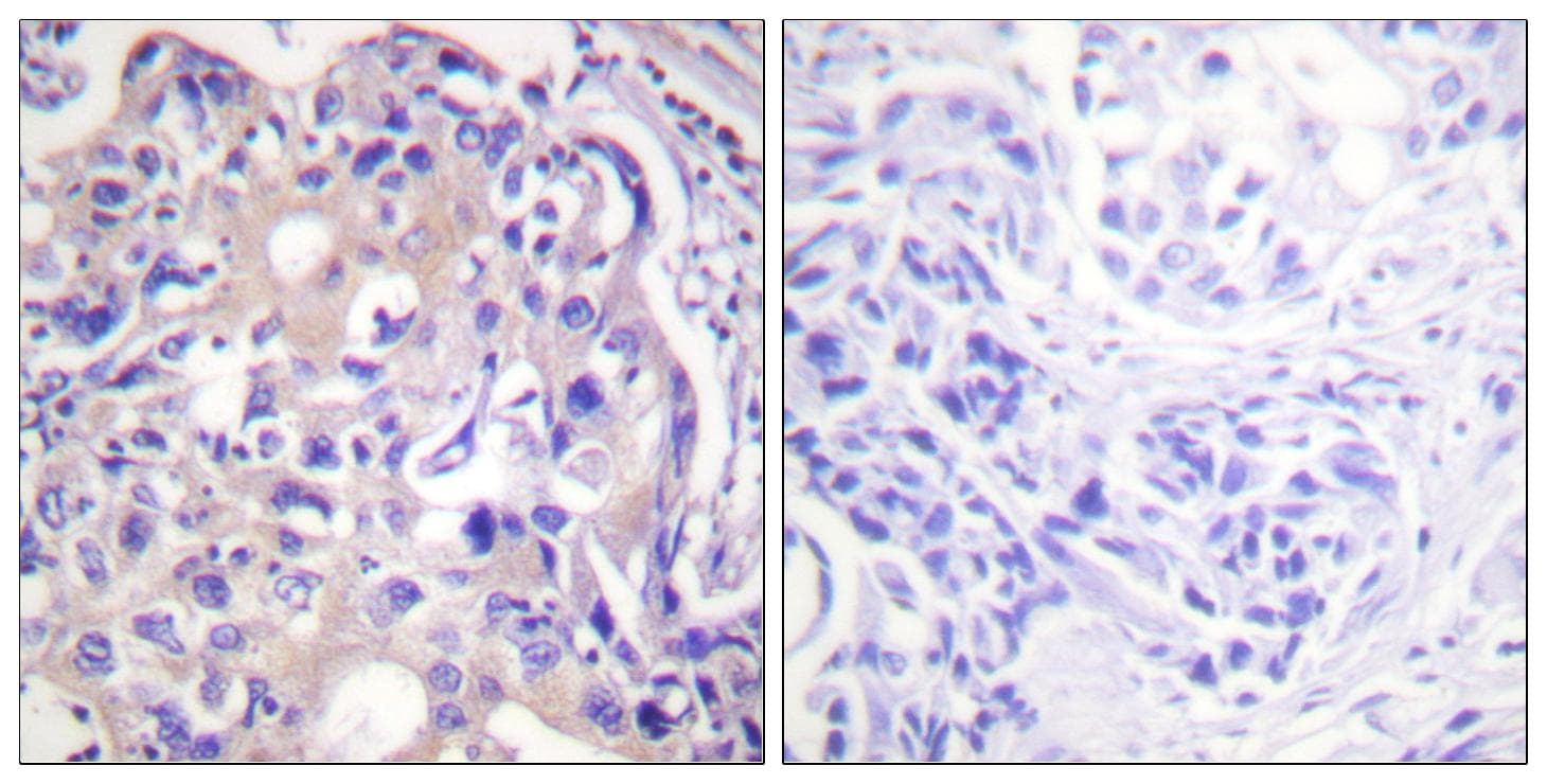 RPS6KA1 / RSK1 Antibody (p380)