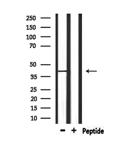 LAMP2 / CD107b Antibody