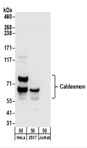 CALD1 / Caldesmon Antibody (aa743-793)