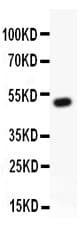 AML1 / RUNX1 Antibody (aa200-233)