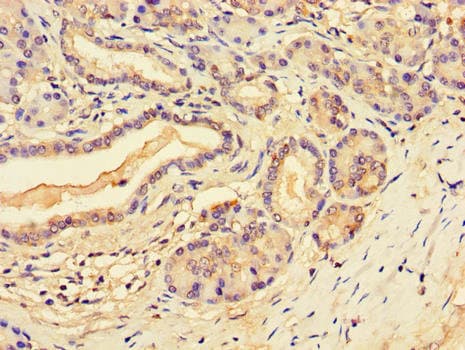 SLFN11 Antibody