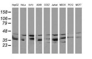Monoclonal Mouse anti-Human MAP2K3 / MEK3 / MKK3 Antibody (clone OTI1B5, IHC, IF, WB)