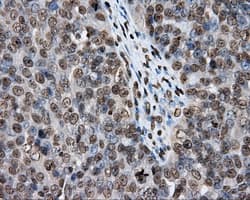 DAPK2 / DAP Kinase 2 Antibody (clone OTI1C5, Carrier-free)