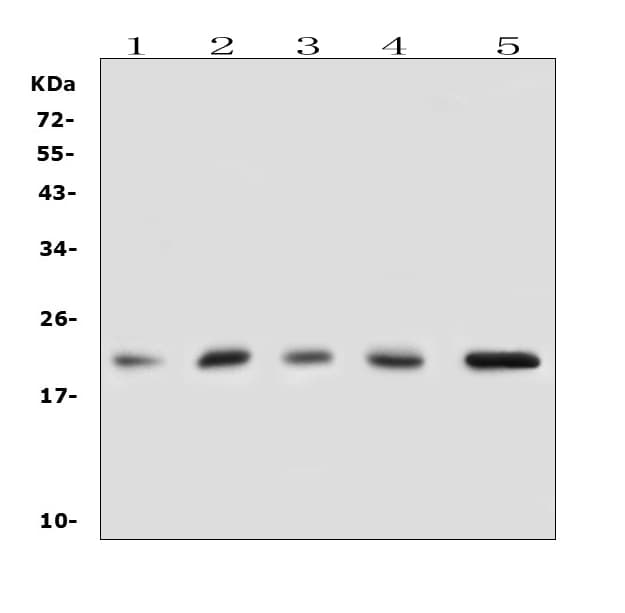 Polyclonal Rabbit anti-Human GPX1 / Glutathione Peroxidase Antibody (aa116-146, IHC, WB)