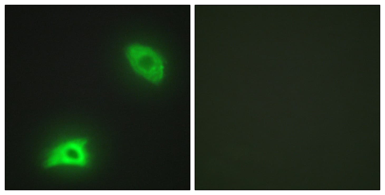 DUSP6 / MKP3 Antibody (aa61-110)