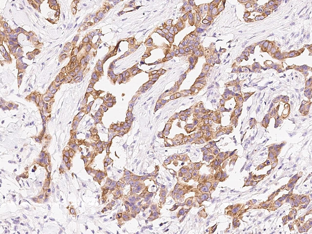 PIGK Antibody