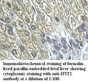 ISG54 / IFIT2 Antibody (aa100-321)