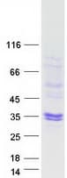 Human SOD3 Protein (Recombinant Myc-DDK (Flag))