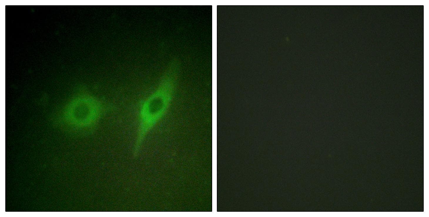 Polyclonal Rabbit anti-Human COL4A2 / Collagen IV Alpha2 Antibody (IHC, IF, WB)