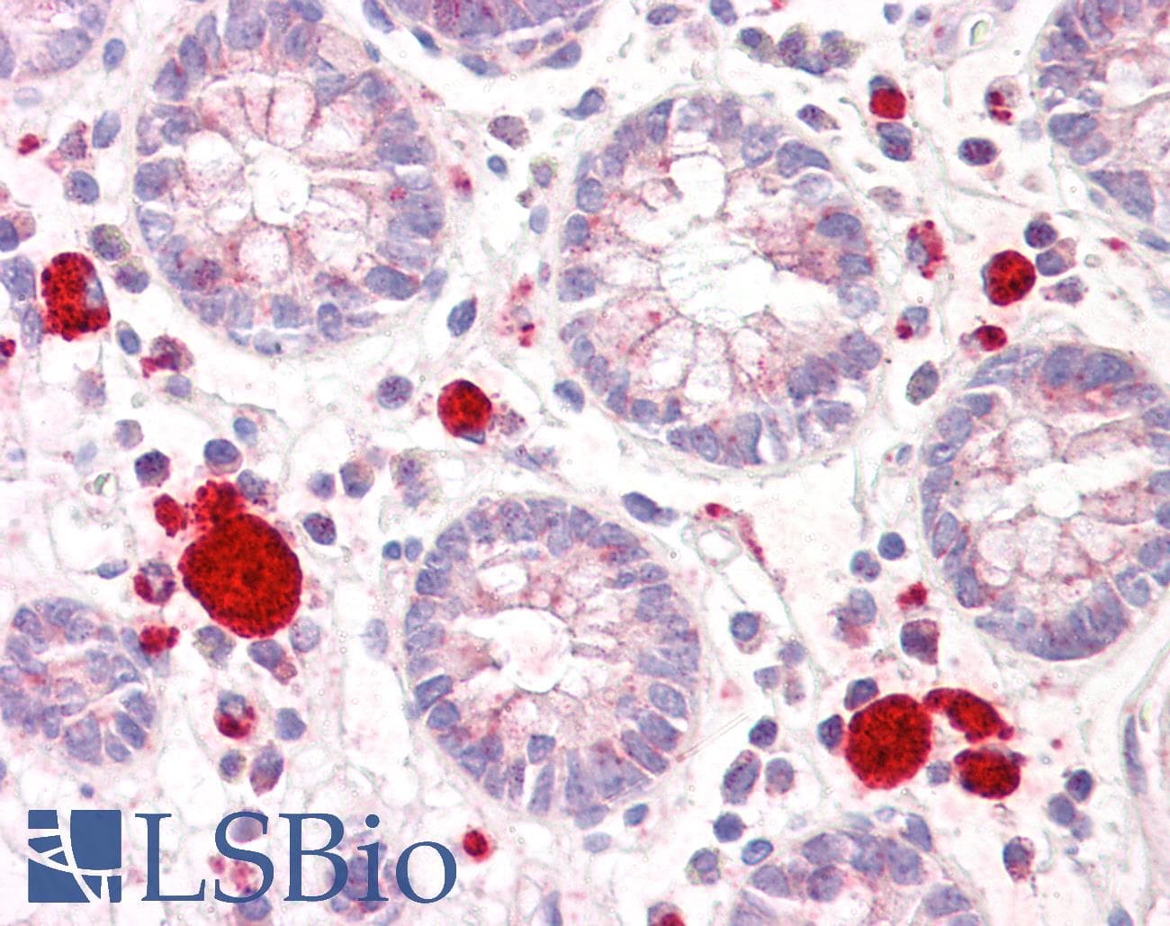 IHC-plus™ Polyclonal Rabbit anti-Human DAPK2 / DAP Kinase 2 Antibody (aa284-333, IHC)