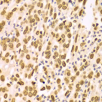 LMNA / Lamin A+C Antibody