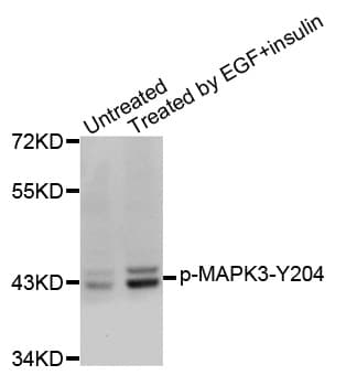 Polyclonal Rabbit anti-Human MAPK3 / ERK1 Antibody (phospho-Tyr204, IHC, IF, WB)