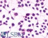 PathPlus™ Polyclonal Rabbit anti-Human CNR1 / CB1 Antibody (C-Terminus, IHC)