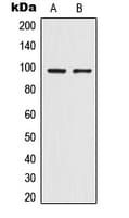 IHC-plus™ Polyclonal Rabbit anti-Human TRPV4 Antibody (Internal, IHC, WB)