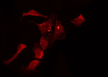 Polyclonal Rabbit anti-Human BIRC5 / Survivin Antibody (IHC, IF, WB)