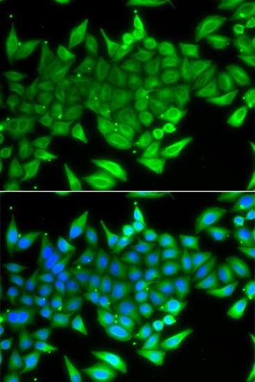 TTF2 / HuF2 Antibody