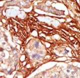 Polyclonal Rabbit anti-Human ARAF / ARAF1 / A-RAF Antibody (aa256-286, IHC, WB)