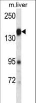 IHC-plus™ PLXNC1 / Plexin C1 Antibody (aa1025-1054)