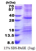 Human CHCHD3 Protein (Recombinant His)
