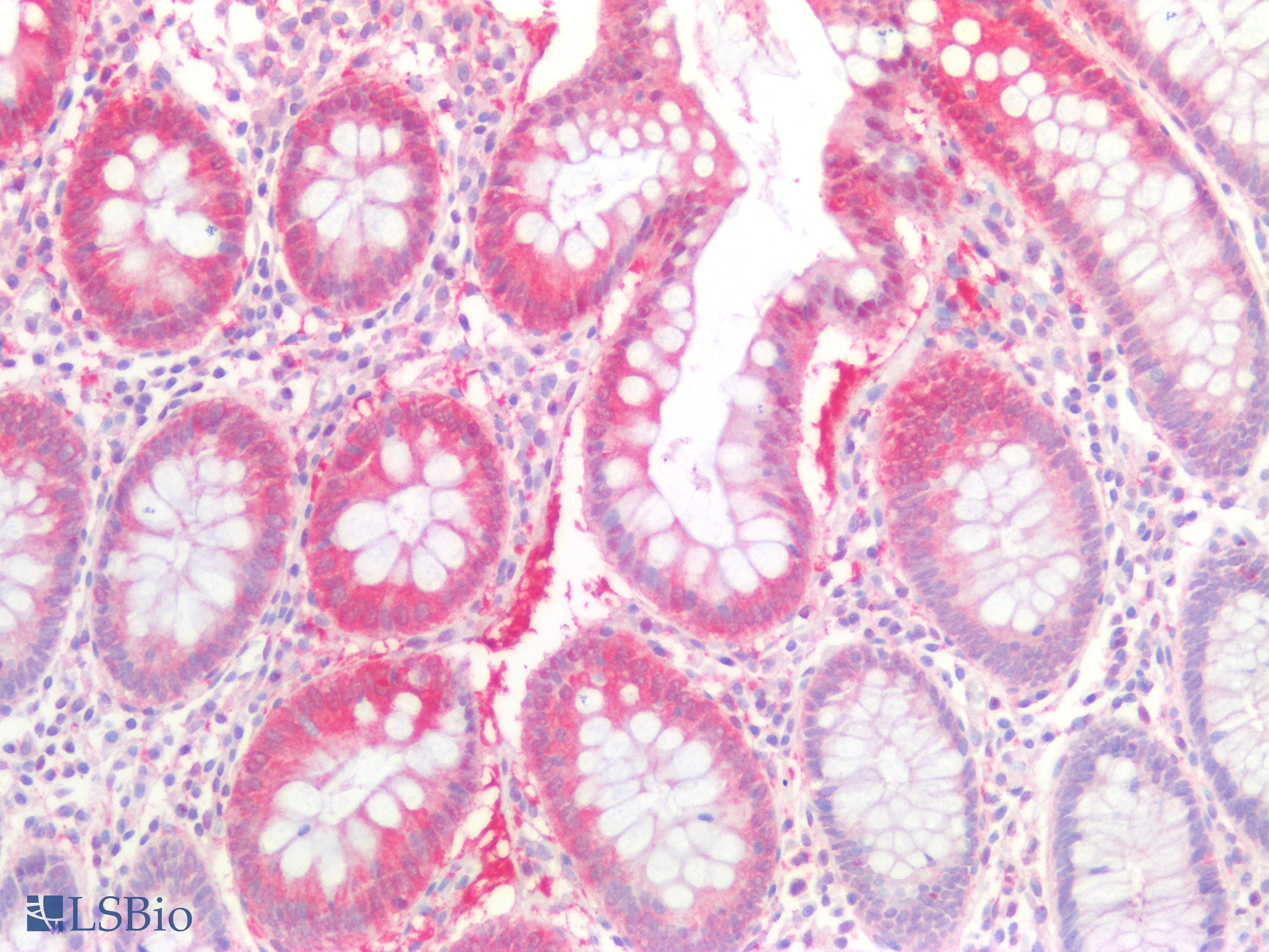 PathPlus™ LDHA / LDH1 Antibody
