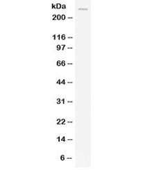 APOB / Apolipoprotein B Antibody