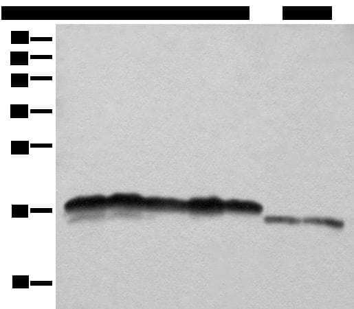 NDUFB11 Antibody