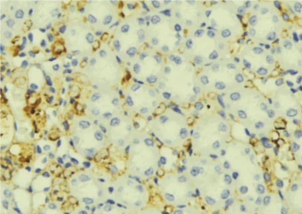 IGFBP5 Antibody