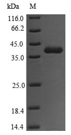 Clostridium difficile toxA / Exotoxin A Protein (Recombinant 6His, N-terminus)