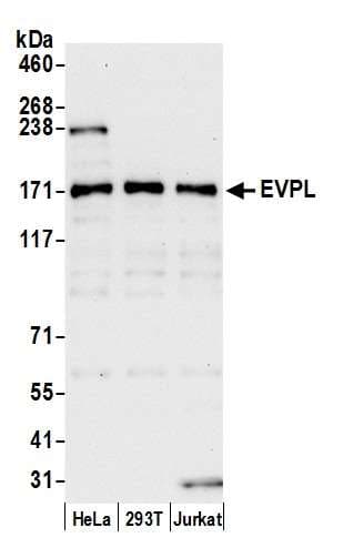 EVPL / Envoplakin Antibody (aa1275-1325)