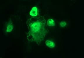 POLR3GL Antibody (clone OTI5F10)