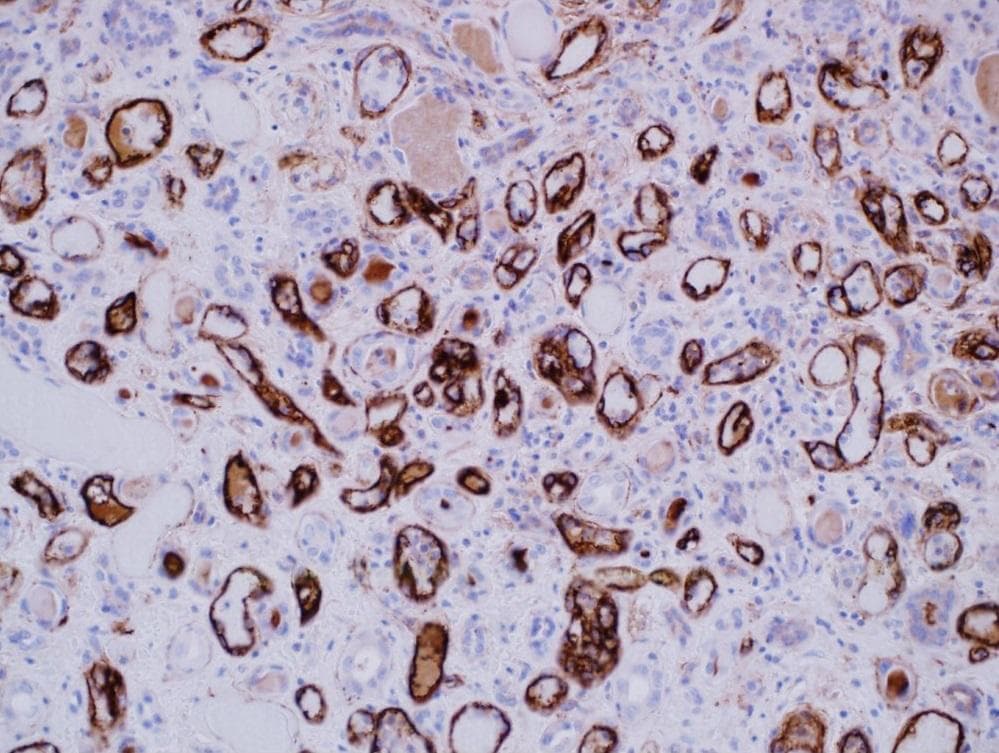Complement C4d Antibody (clone LP69)