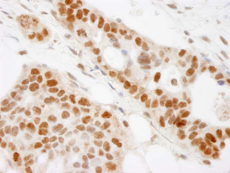BRAT1 / BAAT1 Antibody (aa775-C-term)