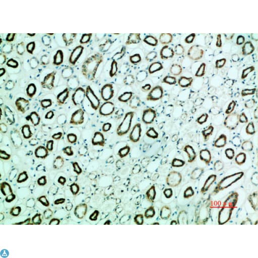 Polyclonal Rabbit anti-Human PTHR / PTHR1 Antibody (WB)
