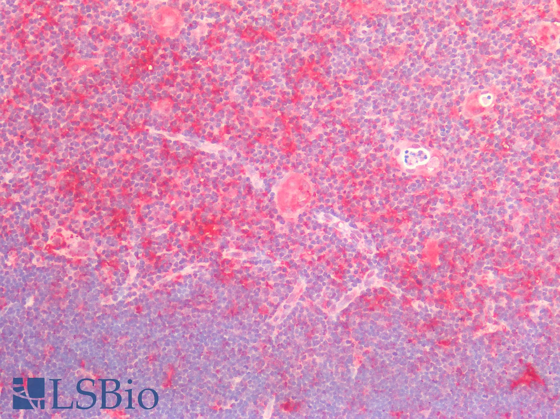IHC-plus™ Polyclonal Rabbit anti-Human CTSV / Cathepsin V Antibody (aa105-334, IHC, WB)