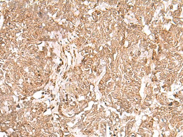 Polyclonal Rabbit anti-Human GMPPB Antibody (IHC)