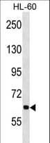 ANKHD1 Antibody (aa445-474)