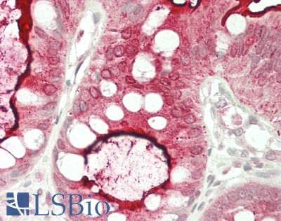 IHC-plus™ CEACAM7 Antibody