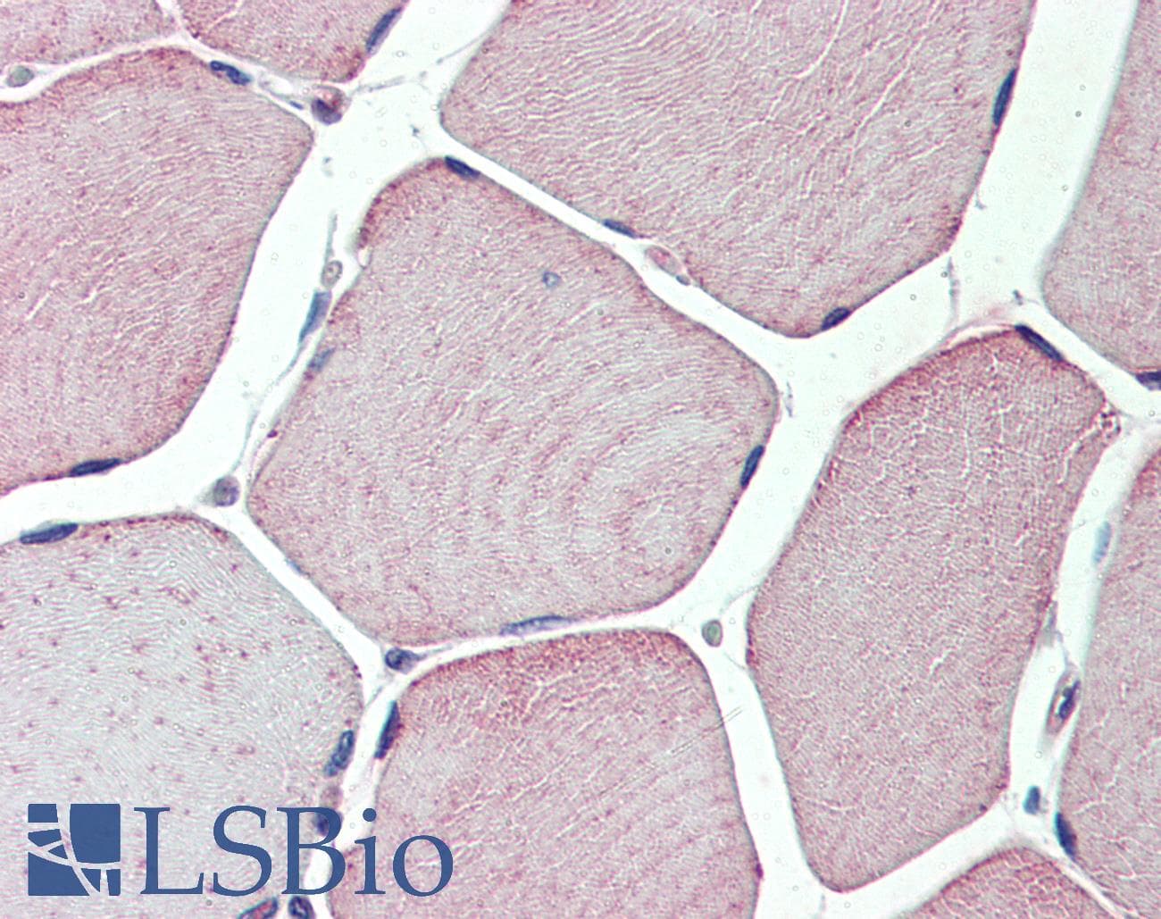 IHC-plus™ TXLNB Antibody (Internal)