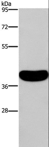 IHC-plus™ Polyclonal Rabbit anti-Human CRELD2 Antibody (IHC, WB)