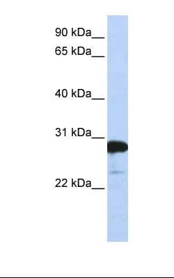 RANBP1 Antibody (C-Terminus)