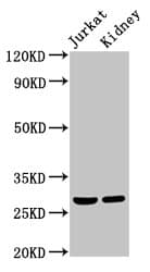 Polyclonal Rabbit anti-Human MSX2 / MSH Antibody (IHC, WB)
