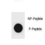 CDKN1B / p27 Kip1 Antibody (phospho-Ser140)