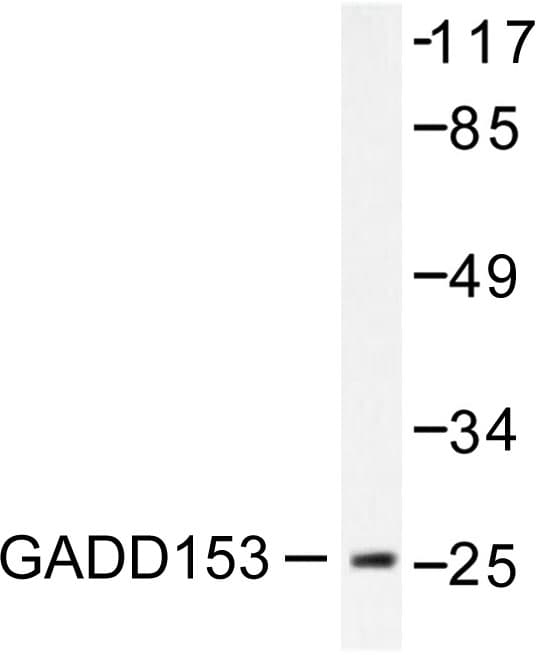 Polyclonal Rabbit anti-Human DDIT3 / CHOP Antibody (Lys121, IHC, IF, WB)