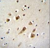 Polyclonal Rabbit anti-Human NIPSNAP3B Antibody (aa189-218, IHC, WB)