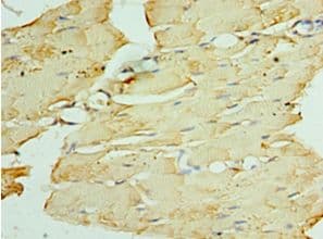 PNPLA2 / ATGL Antibody (aa265-504)